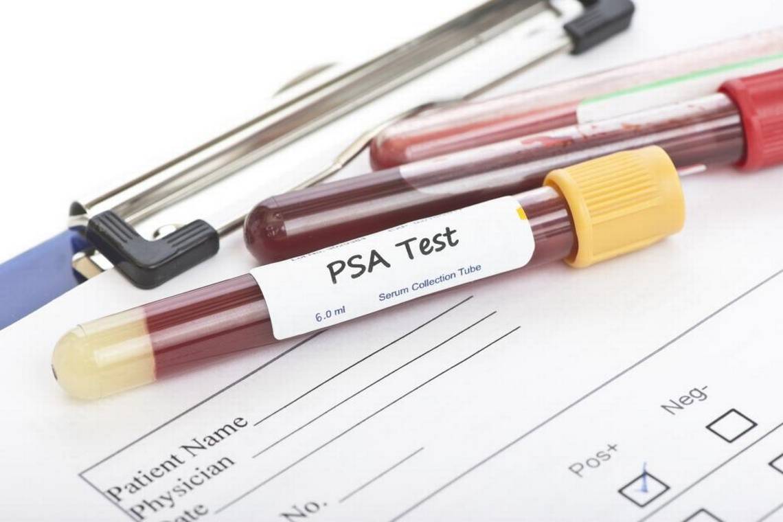 annual-psa-screening-needed-or-not-pcaaware